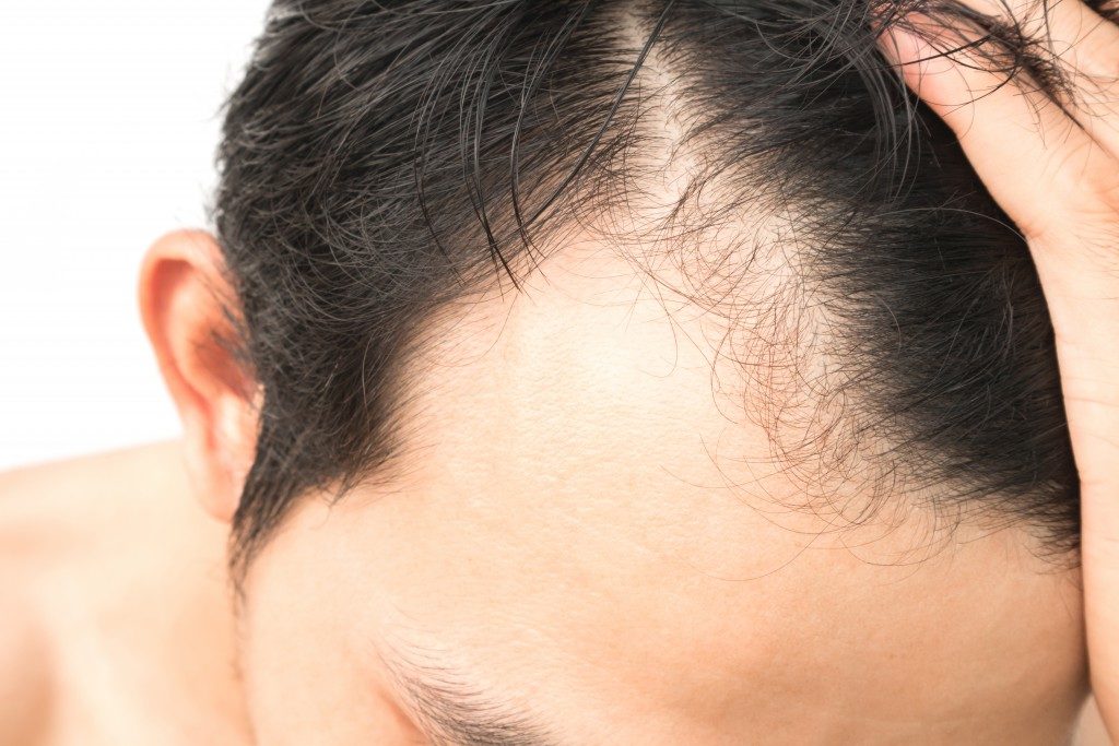 Man scalp up close