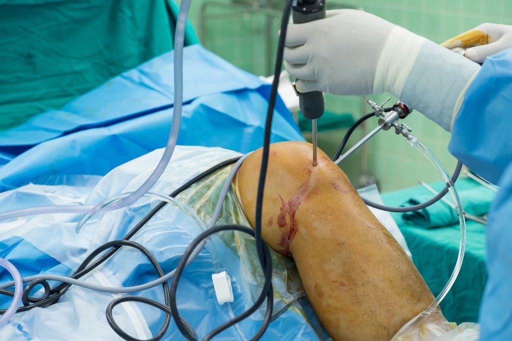 person undergoing knee surgery